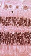 Human Retina.  Image courtesy Janet Sparrow