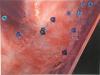 athos_artery_view_2