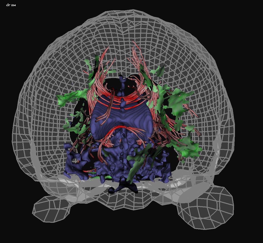Color Rapid Prototyping for Diffusion Tensor {MRI} Visualization