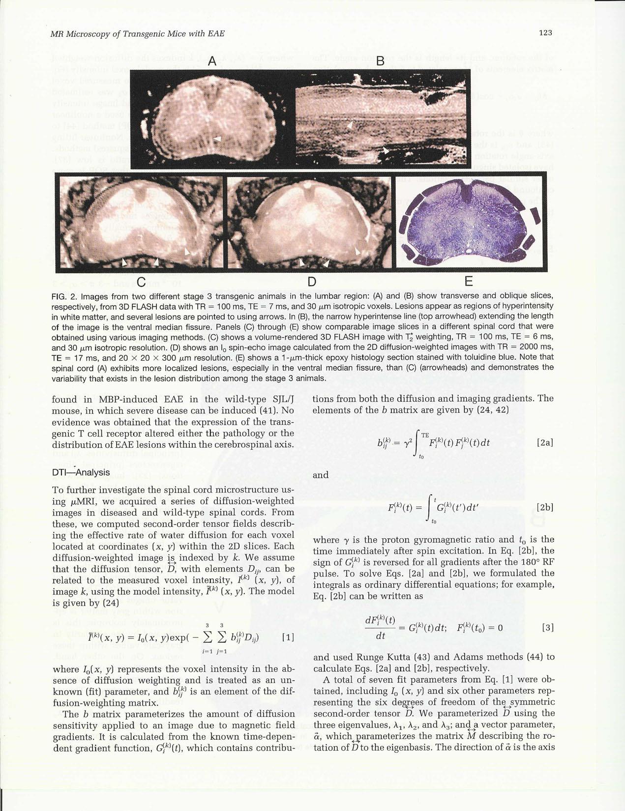{MR} Microscopy of Transgenic Mice that Spontaneously Aquire Experimental Allergic Encephalomyelitis