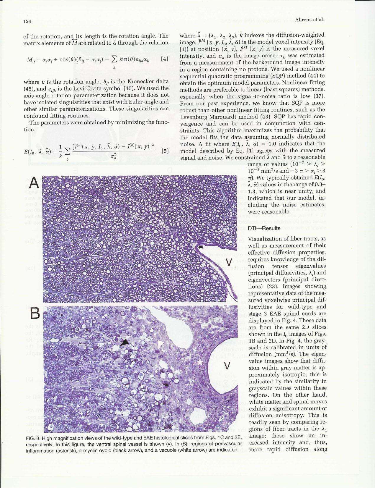 {MR} Microscopy of Transgenic Mice that Spontaneously Aquire Experimental Allergic Encephalomyelitis