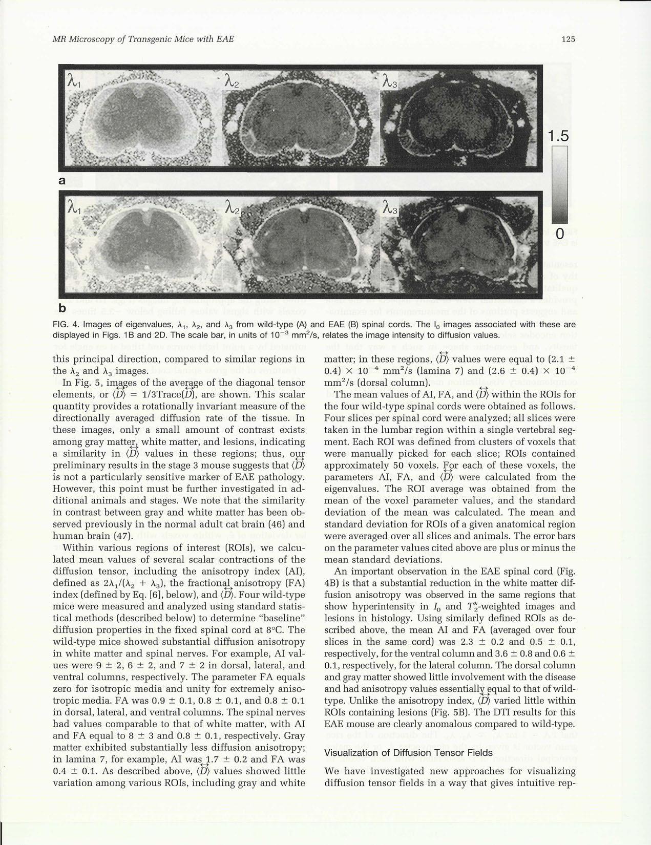 {MR} Microscopy of Transgenic Mice that Spontaneously Aquire Experimental Allergic Encephalomyelitis