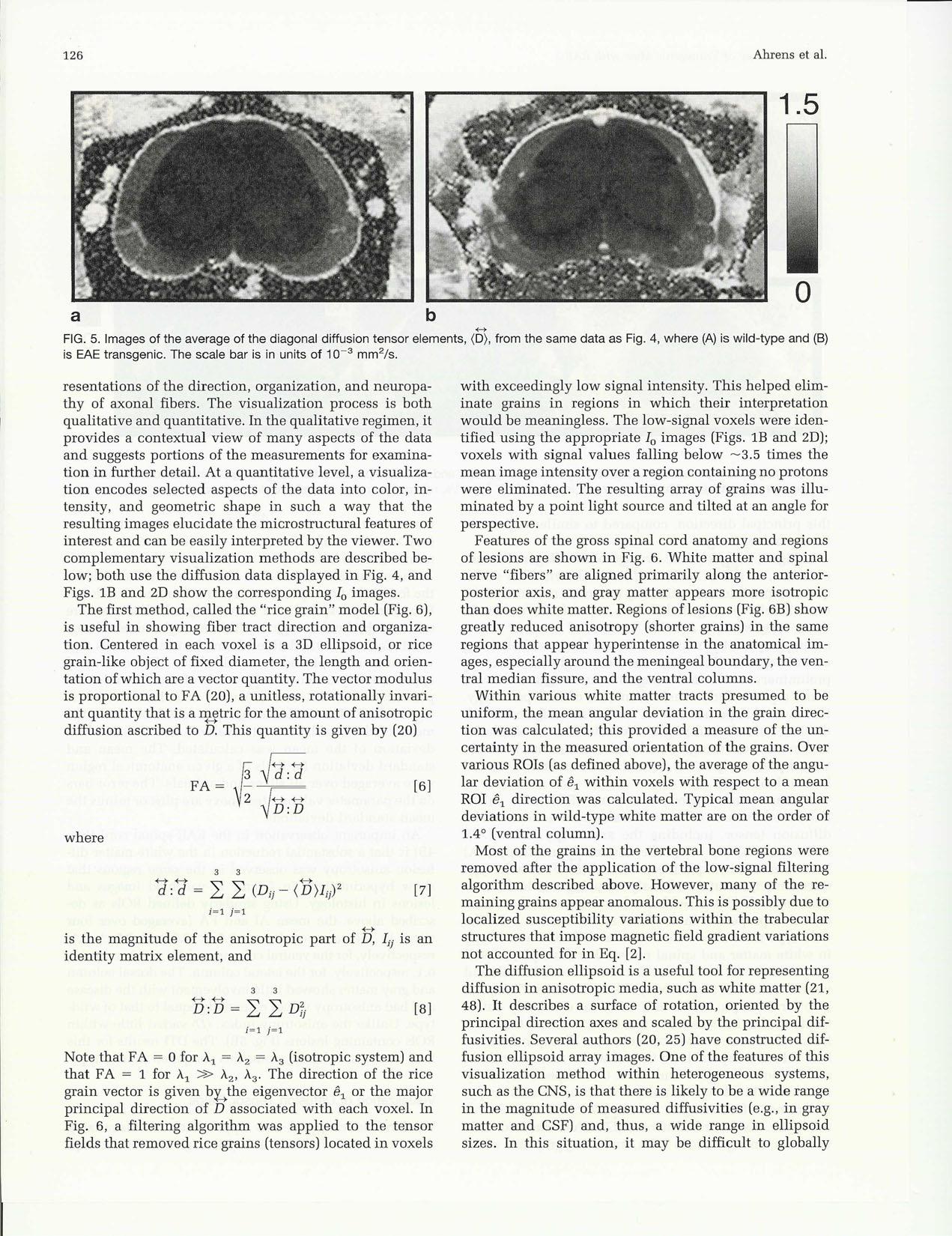 {MR} Microscopy of Transgenic Mice that Spontaneously Aquire Experimental Allergic Encephalomyelitis