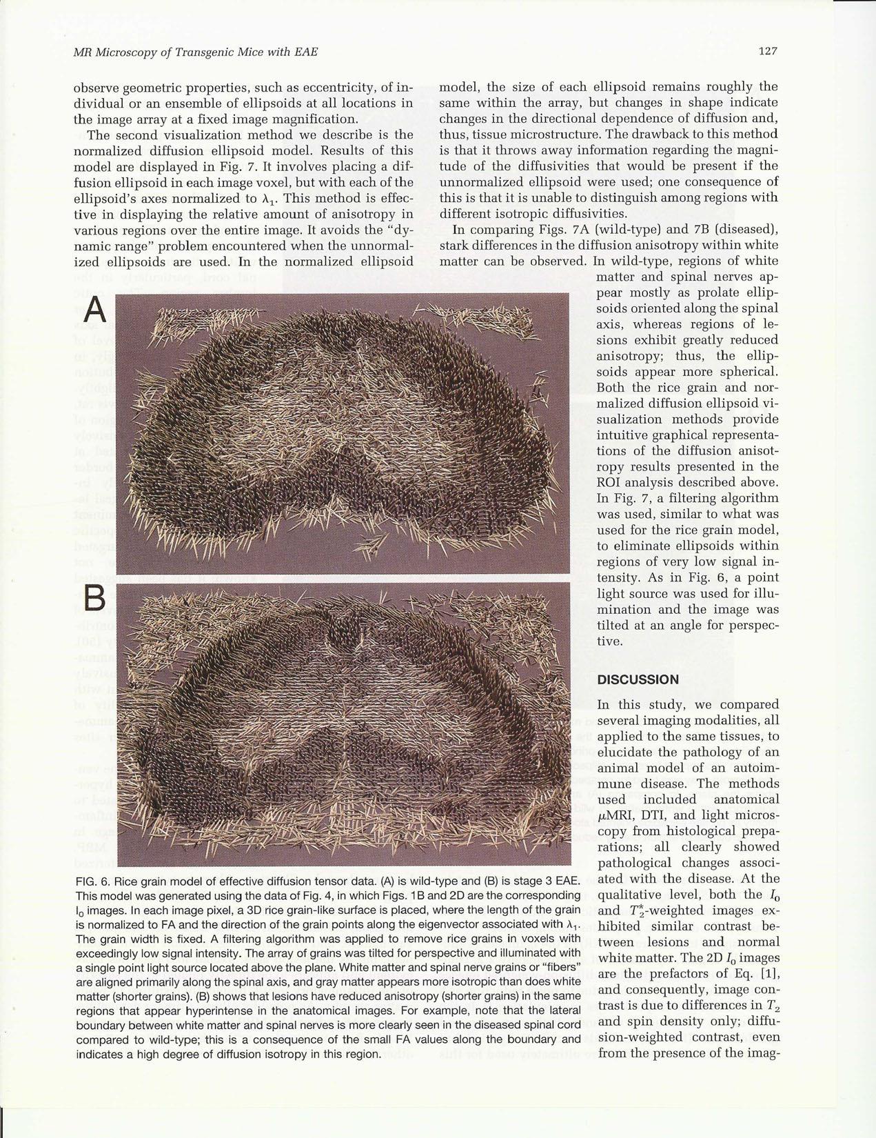 {MR} Microscopy of Transgenic Mice that Spontaneously Aquire Experimental Allergic Encephalomyelitis