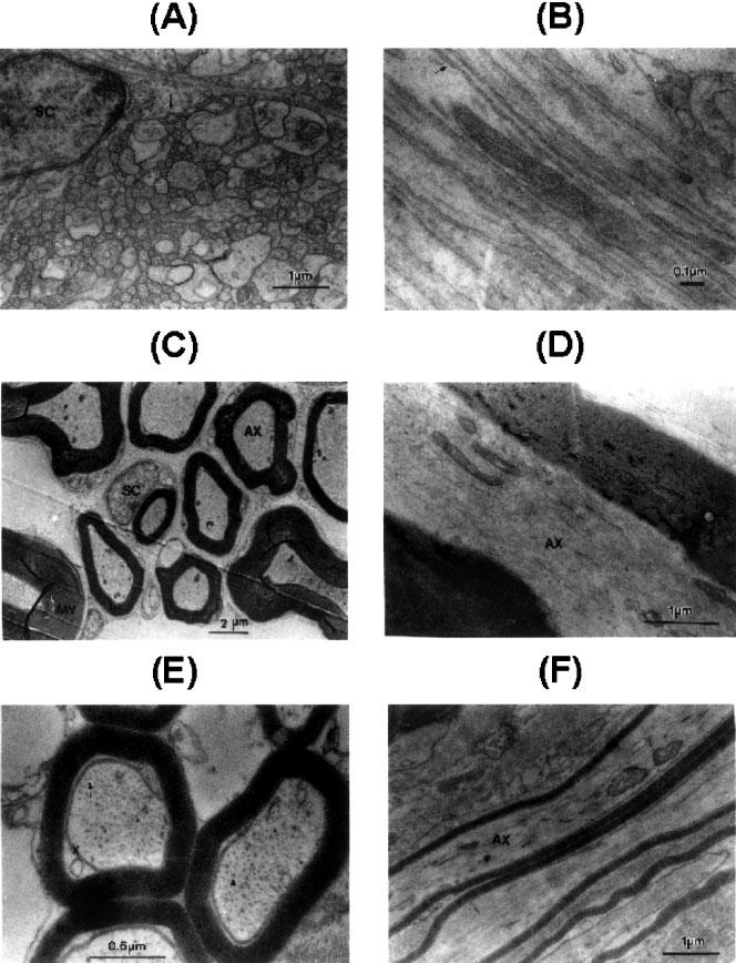 The Basis of Anisotropic Water Diffusion in the Nervous System - A Technical Review