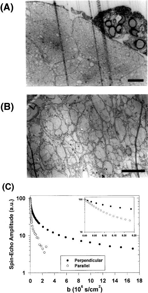 The Basis of Anisotropic Water Diffusion in the Nervous System - A Technical Review