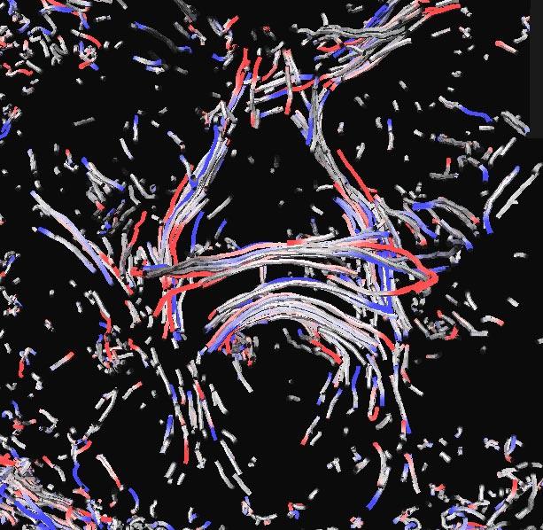 Visualizing Diffusion Tensor Volume Differences