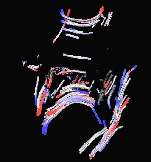 Visualizing Diffusion Tensor Volume Differences