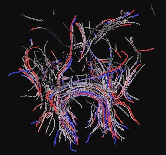 Visualizing the Differences between Diffusion Tensor Volume Images
