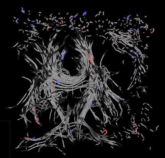 Visualizing the Differences between Diffusion Tensor Volume Images