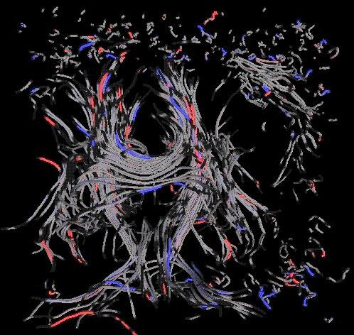 Visualizing the Differences between Diffusion Tensor Volume Images