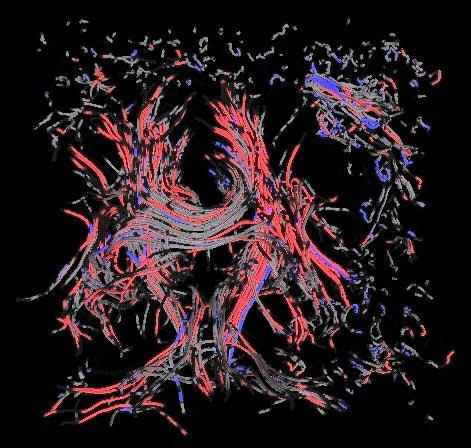 Visualizing the Differences between Diffusion Tensor Volume Images