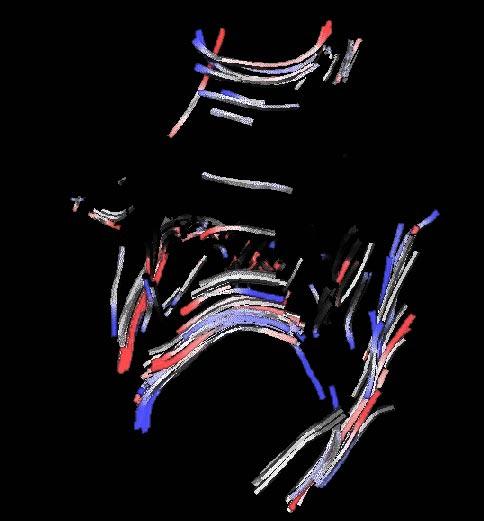 Visualizing the Differences between Diffusion Tensor Volume Images