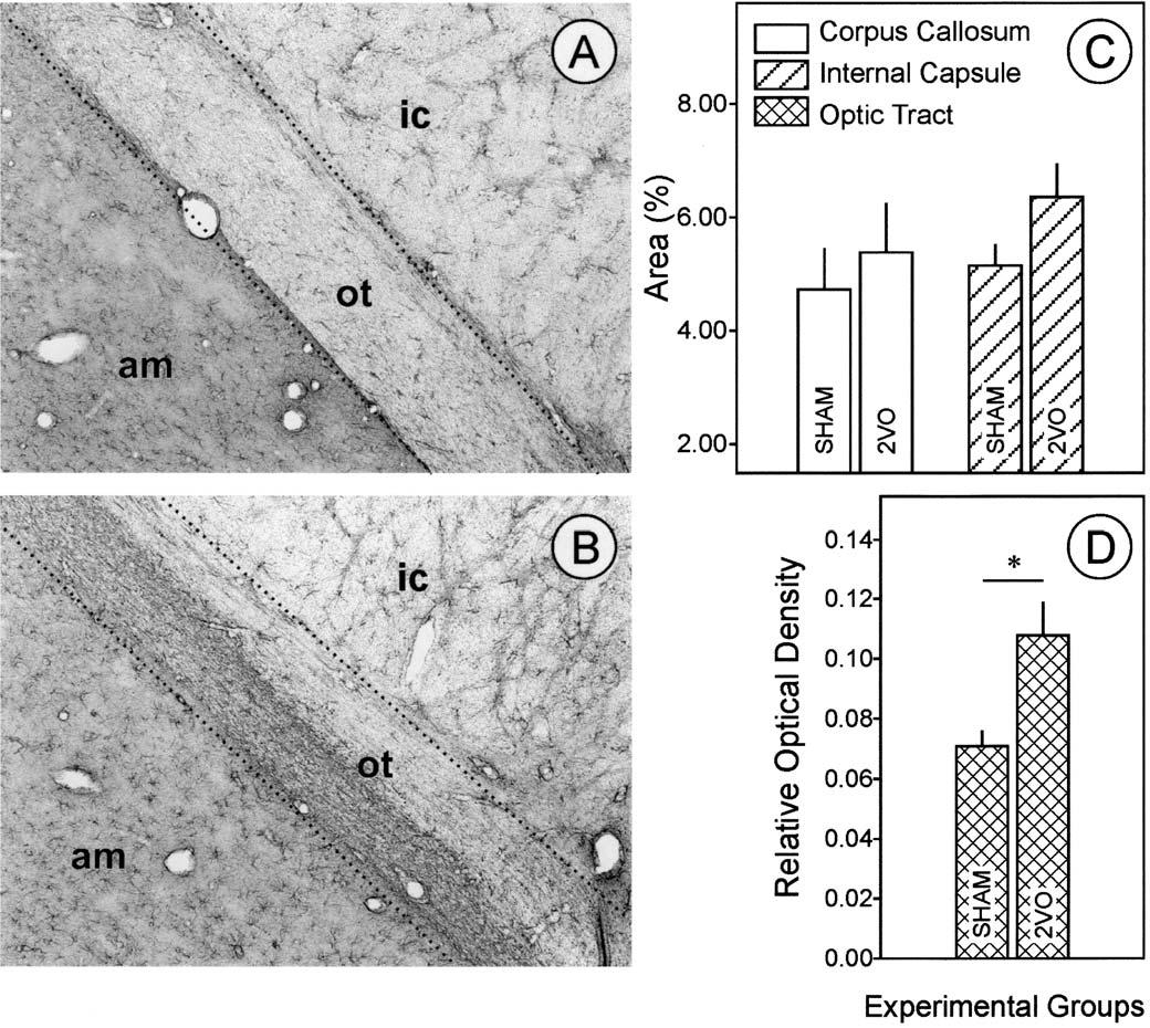 Experimental cerebral hypoperfusion induces white matter injury and microglial activation in the rat brain