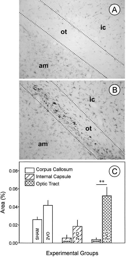 Experimental cerebral hypoperfusion induces white matter injury and microglial activation in the rat brain