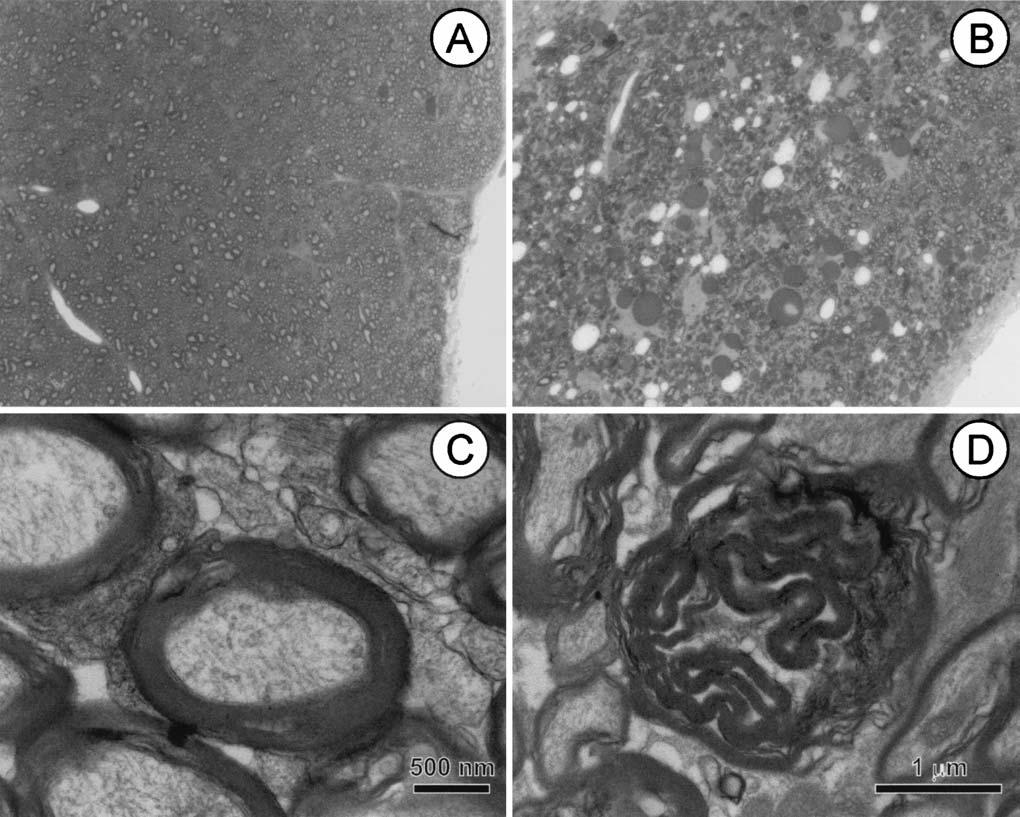 Experimental cerebral hypoperfusion induces white matter injury and microglial activation in the rat brain
