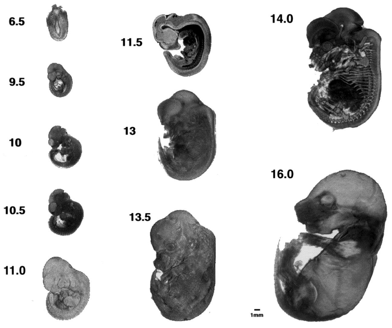 Towards a Micro{MRI} Atlas of Mouse Development
