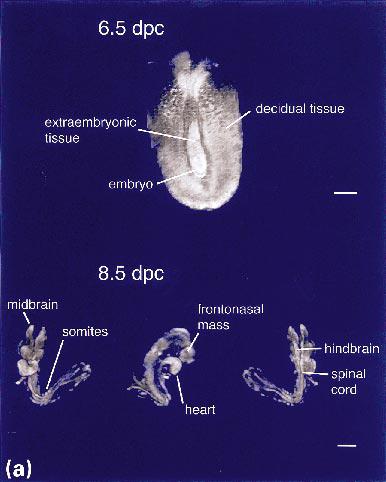 Towards a Micro{MRI} Atlas of Mouse Development