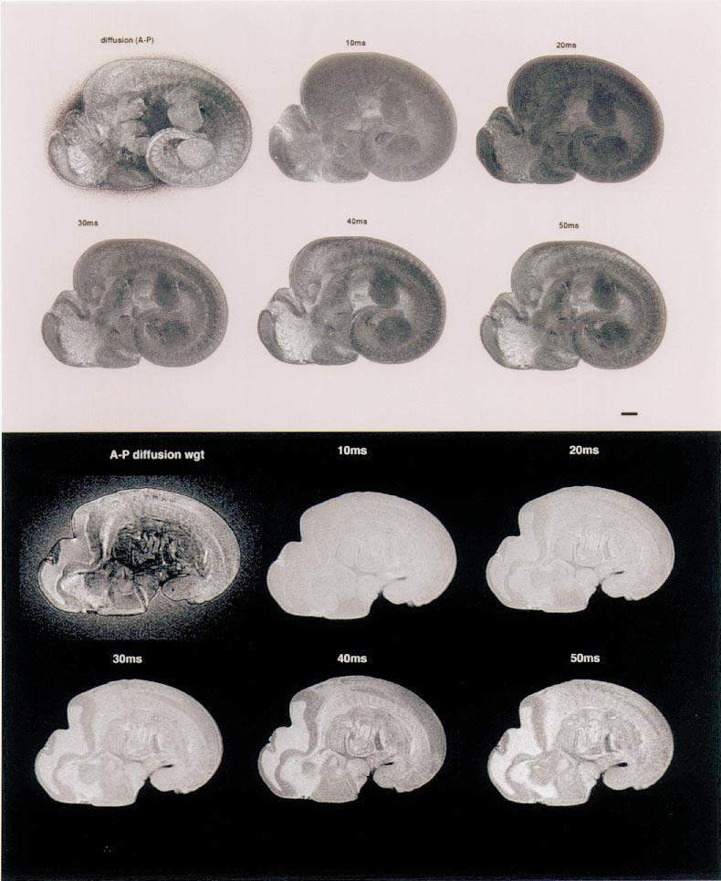 Towards a Micro{MRI} Atlas of Mouse Development