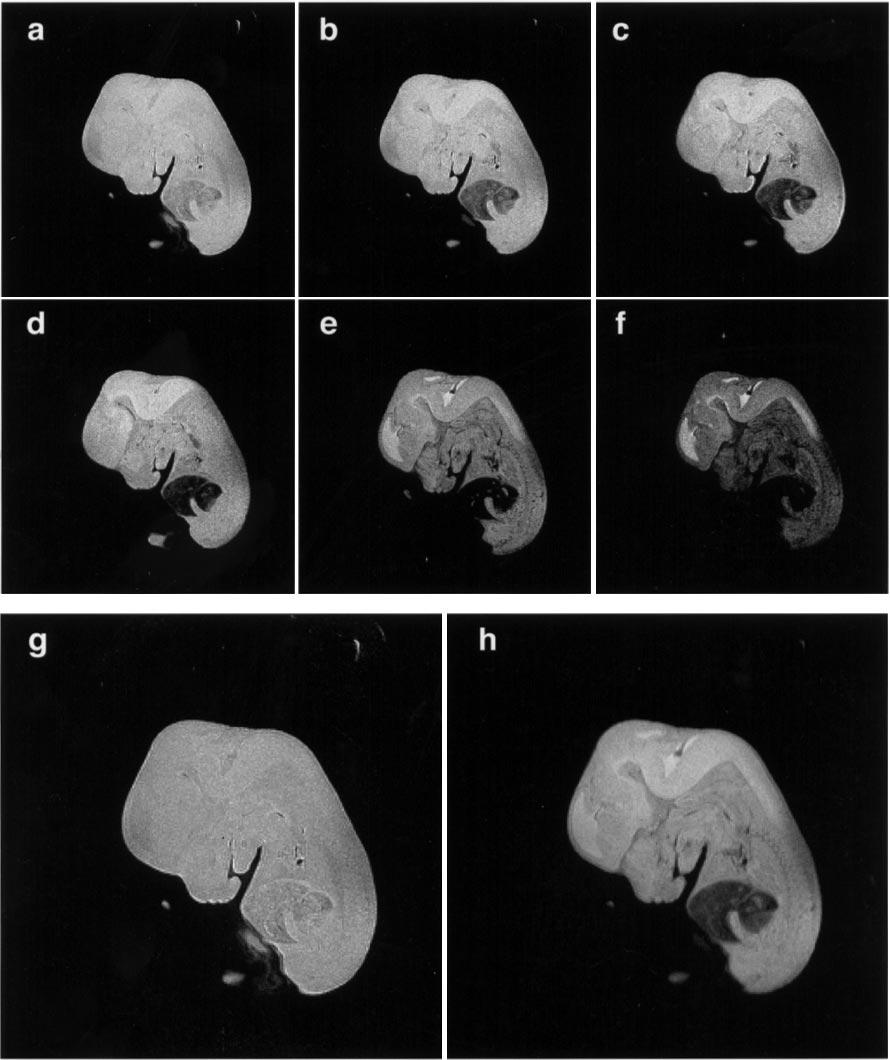 Towards a Micro{MRI} Atlas of Mouse Development