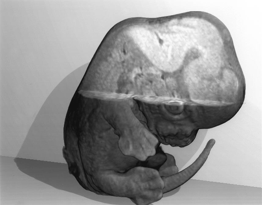 Towards a Micro{MRI} Atlas of Mouse Development
