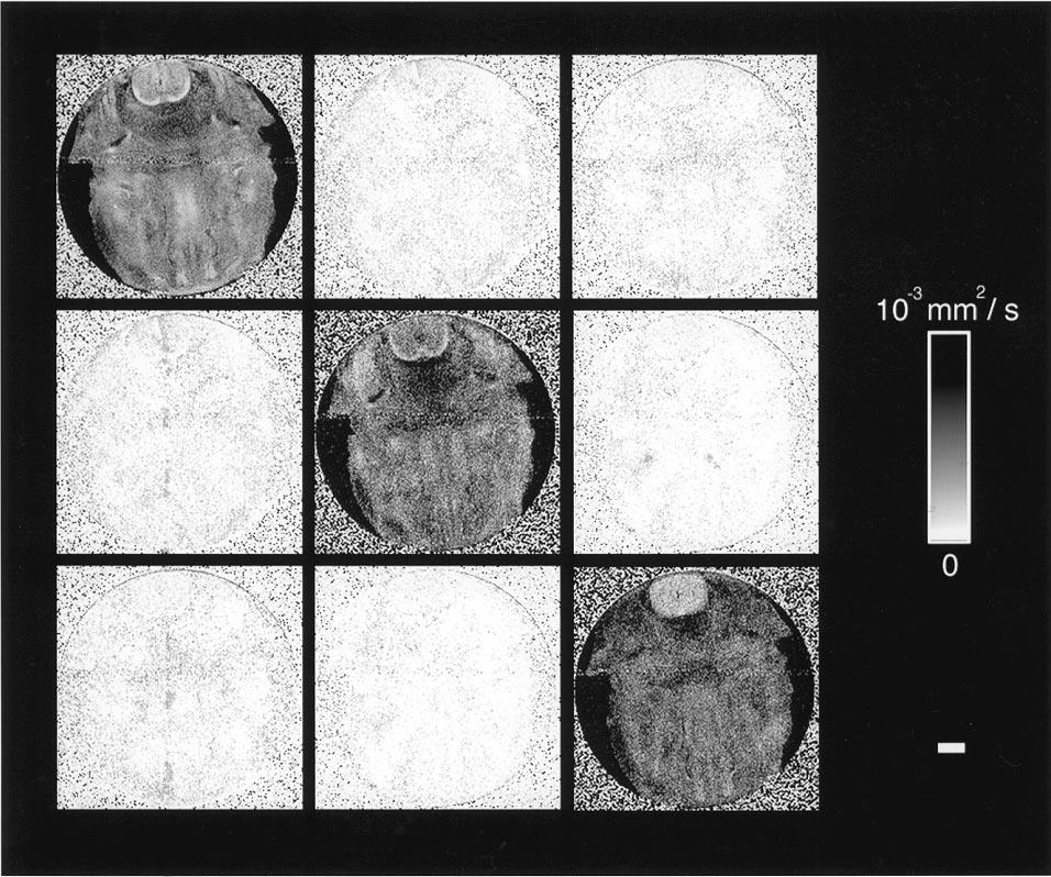 Towards a Micro{MRI} Atlas of Mouse Development
