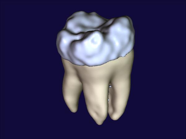 Partial-Volume {B}ayesian Classification of Material Mixtures in {MR} Volume Data Using Voxel Histograms