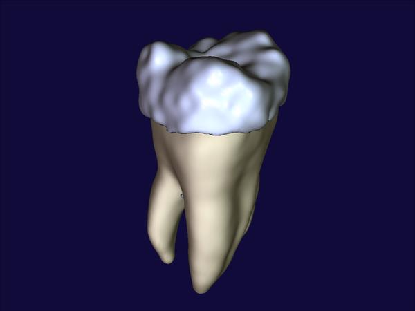 Partial-Volume {B}ayesian Classification of Material Mixtures in {MR} Volume Data Using Voxel Histograms