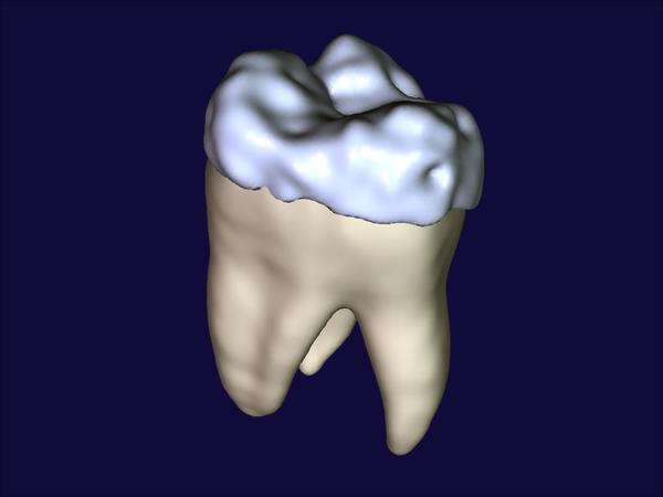 Partial-Volume {B}ayesian Classification of Material Mixtures in {MR} Volume Data Using Voxel Histograms