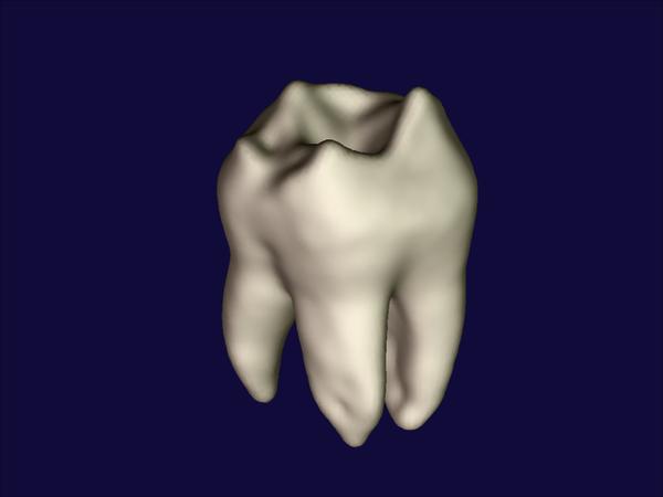 Partial-Volume {B}ayesian Classification of Material Mixtures in {MR} Volume Data Using Voxel Histograms