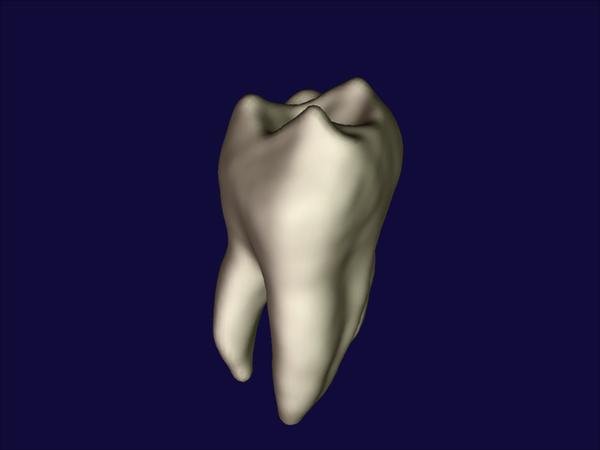 Partial-Volume {B}ayesian Classification of Material Mixtures in {MR} Volume Data Using Voxel Histograms