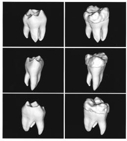 Partial-Volume {B}ayesian Classification of Material Mixtures in {MR} Volume Data Using Voxel Histograms