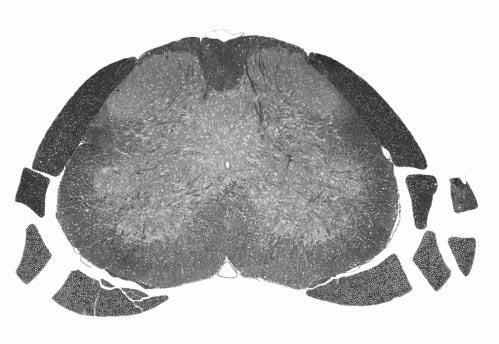 Visualizing Diffusion Tensor Images of the Mouse Spinal Cord