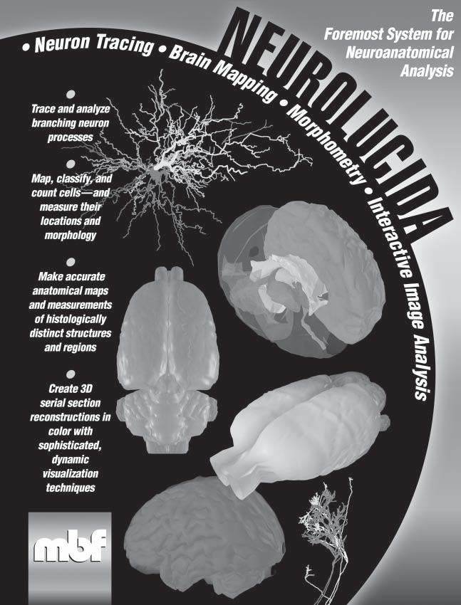 Applying Lessons from Visual Art to Exploration of the Brain