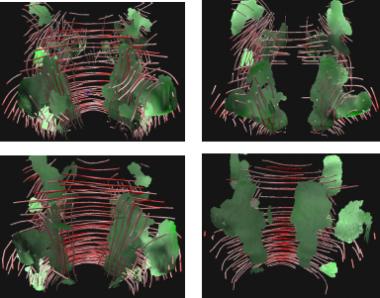 Ramifications of Isotropic Sampling and Acquisition Orientation on {DTI} Analyses