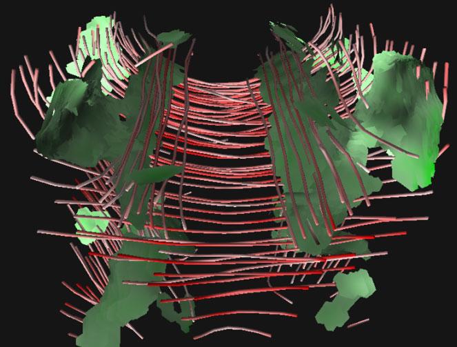 Ramifications of Isotropic Sampling and Acquisition Orientation on {DTI} Analyses