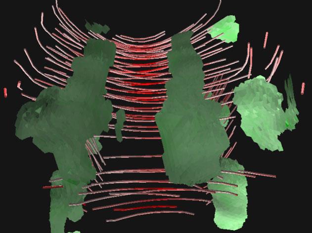 Ramifications of Isotropic Sampling and Acquisition Orientation on {DTI} Analyses