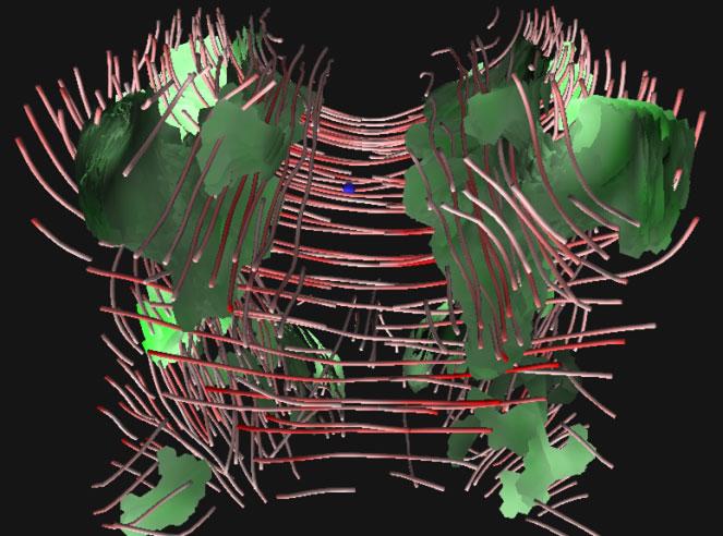Ramifications of Isotropic Sampling and Acquisition Orientation on {DTI} Analyses