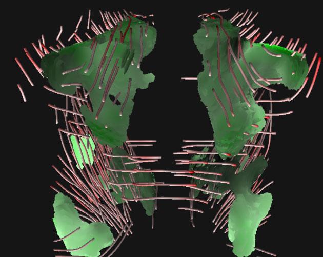 Ramifications of Isotropic Sampling and Acquisition Orientation on {DTI} Analyses