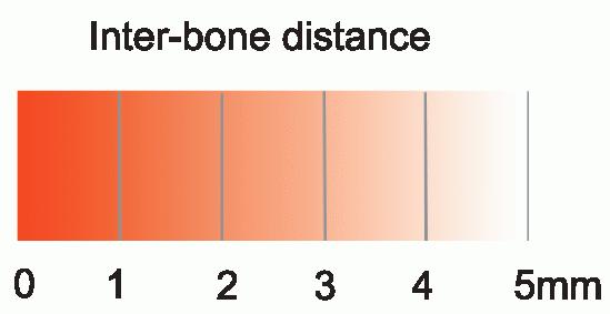 Visualization of Contact Areas and Ligament Paths in Joints