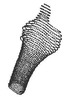 Estimating joint contact areas and ligament lengths from bone kinematics and surfaces