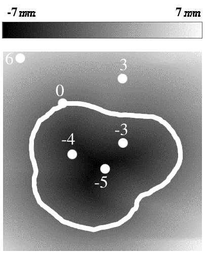 Estimating joint contact areas and ligament lengths from bone kinematics and surfaces