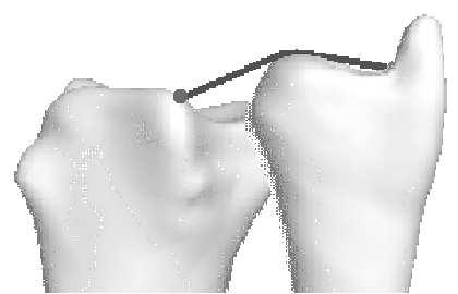 Estimating joint contact areas and ligament lengths from bone kinematics and surfaces