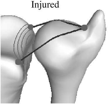 Estimating joint contact areas and ligament lengths from bone kinematics and surfaces
