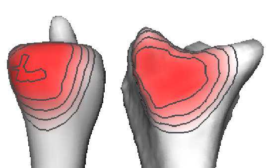 JointViewer an interactive system for exploring orthopedic data