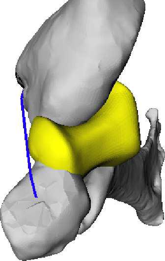 JointViewer an interactive system for exploring orthopedic data