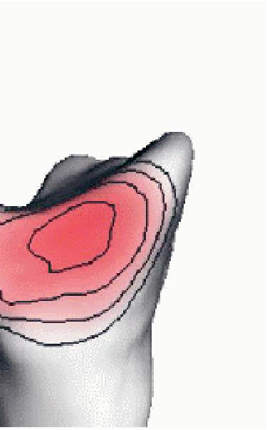 JointViewer an interactive system for exploring orthopedic data