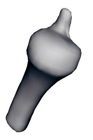 JointViewer an interactive system for exploring orthopedic data