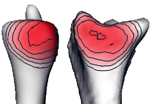 JointViewer an interactive system for exploring orthopedic data