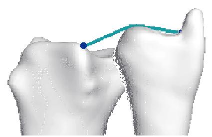 JointViewer an interactive system for exploring orthopedic data